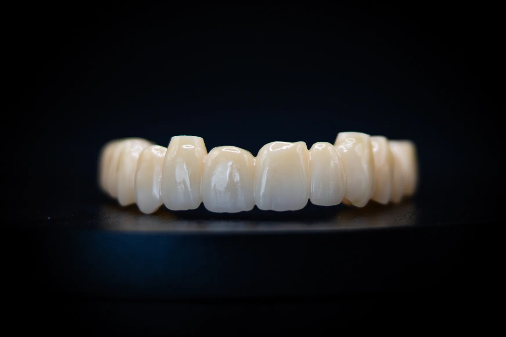 Kroon/brug voorbeeld 3