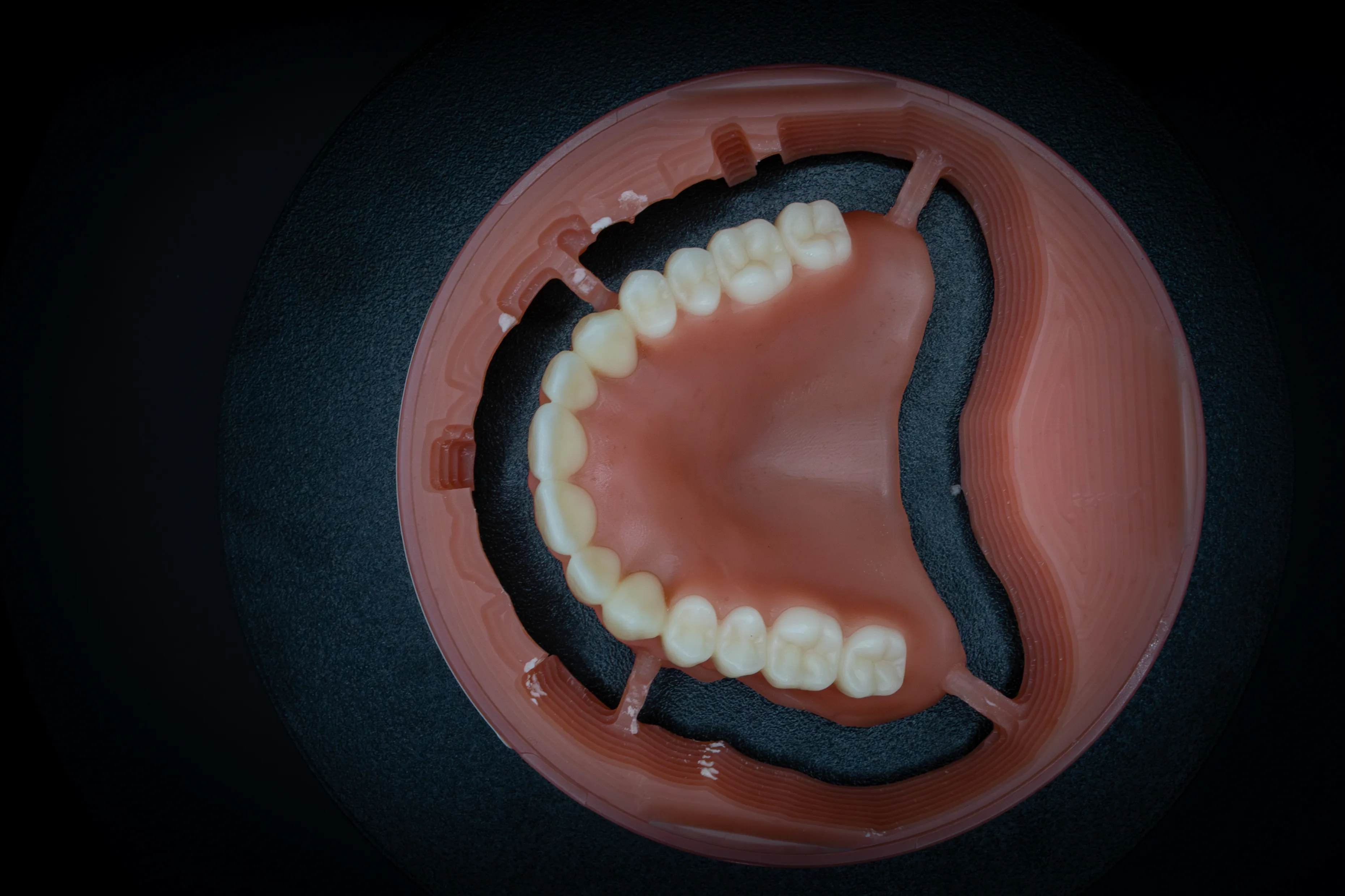 Digitale prothese – oversize milling voorbeeld 1