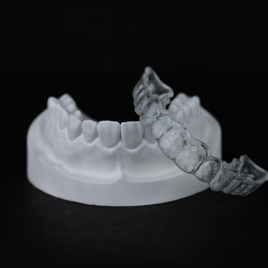 Splints & nightguards